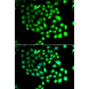 Immunofluorescence analysis of A549 cells using TCEAL8 antibody (abx006248). Blue: DAPI for nuclear staining.