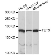 Western blot analysis of extracts of various cell lines, using TET3 antibody (abx006255) at 1/1000 dilution.