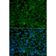 Immunofluorescence analysis of A549 cells using WDR45 antibody (abx006258). Blue: DAPI for nuclear staining.