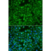 Immunofluorescence analysis of A549 cells using MTMR4 antibody (abx006259). Blue: DAPI for nuclear staining.