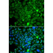 Immunofluorescence analysis of A549 cells using RRAGA antibody (abx006261). Blue: DAPI for nuclear staining.