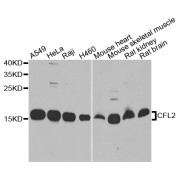 Western blot analysis of extracts of various cell lines, using CFL2 antibody (abx006263) at 1/1000 dilution.