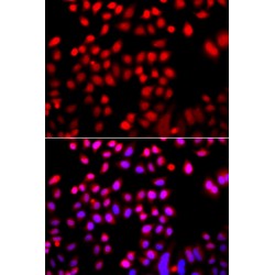 Cofilin 2 (CFL2) Antibody