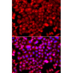 NADH Ubiquinone Oxidoreductase Core Subunit V1 (NDUFV1) Antibody