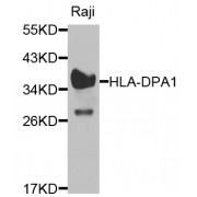 Western blot analysis of extracts of Raji cells, using HLA-DPA1 antibody (abx006268) at 1/1000 dilution.