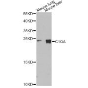 Western blot analysis of extracts of various cell lines, using C1QA Antibody (abx006271) at 1/1000 dilution.