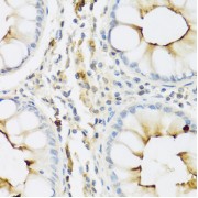 Immunohistochemistry of paraffin-embedded human colon using RNASE3 antibody (abx006273) at dilution of 1/100 (40x lens).