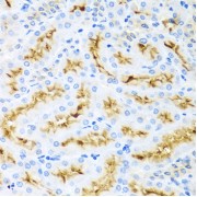 Immunohistochemistry of paraffin-embedded rat kidney using CCL22 antibody (abx006276) at dilution of 1/100 (40x lens).