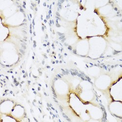 C-C Motif Chemokine 22 (CCL22) Antibody