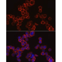 Cathepsin G (CTSG) Antibody