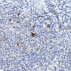 Cathepsin G (CTSG) Antibody