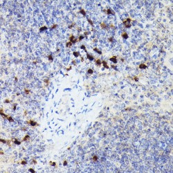 Cathepsin G (CTSG) Antibody