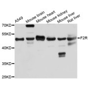 Western blot analysis of extracts of various cell lines, using F2R antibody (abx006301) at 1/1000 dilution.