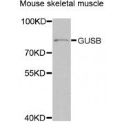 Western blot analysis of extracts of mouse skeletal muscle, using GUSB antibody (abx006313) at 1/1000 dilution.
