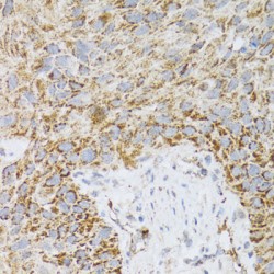 Prodynorphin (PDYN) Antibody