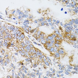 Prodynorphin (PDYN) Antibody