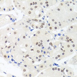 Non-Histone Chromosomal Protein HMG-14 (HMGN1) Antibody