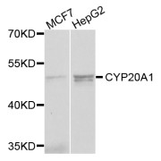 Western blot analysis of extracts of various cell lines, using CYP20A1 antibody (abx006351) at 1/1000 dilution.