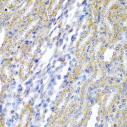 Cytochrome P450 20A1 (CYP20A1) Antibody
