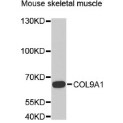 Western blot analysis of extracts of mouse skeletal muscle, using COL9A1 antibody (abx006360) at 1/1000 dilution.