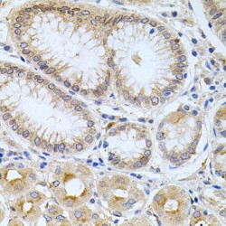 Carboxypeptidase M (CPM) Antibody