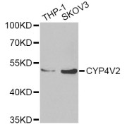 Western blot analysis of extracts of various cell lines, using CYP4V2 Antibody (abx006362) at 1/1000 dilution.