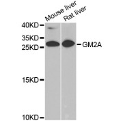 Western blot analysis of extracts of various cell lines, using GM2A antibody (abx006368) at 1/1000 dilution.