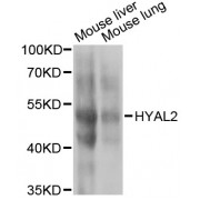 Western blot analysis of extracts of various cell lines, using HYAL2 antibody (abx006373) at 1/1000 dilution.