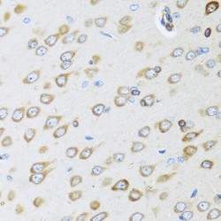 Mimecan (OGN) Antibody