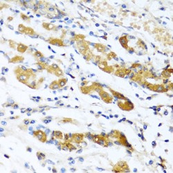 Mimecan (OGN) Antibody