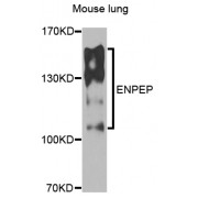 Western blot analysis of extracts of mouse lung, using ENPEP antibody (abx006402) at 1/1000 dilution.