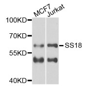 Western blot analysis of extracts of various cell lines, using SS18 antibody (abx006411) at 1/1000 dilution.