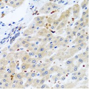 Immunohistochemistry of paraffin-embedded human liver using RGS5 antibody (abx006413) at dilution of 1/100 (40x lens).