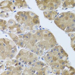 Neuromedin-U-25 (NMU) Antibody