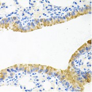 Immunohistochemistry of paraffin-embedded mouse lung using TOB2 antibody (abx006441) at dilution of 1/100 (40x lens).