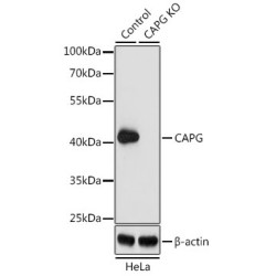 Macrophage-Capping Protein (CAPG) Antibody