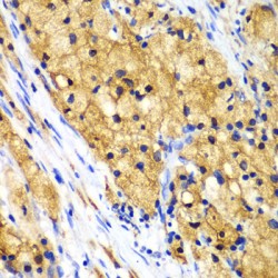 Macrophage-Capping Protein (CAPG) Antibody