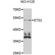 Western blot analysis of extracts of NCI-H125 cells, using ETS2 antibody (abx006449) at 1/1000 dilution.