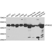 Western blot analysis of extracts of various cell lines, using PHKG2 antibody (abx006451) at 1/1000 dilution.