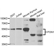 Western blot analysis of extracts of various cell lines, using PON1 antibody (abx006452) at 1/1000 dilution.