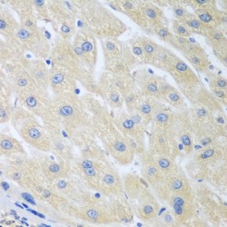 Serum Paraoxonase / Arylesterase 1 (PON1) Antibody