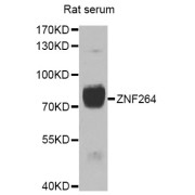 Western blot analysis of extracts of rat serum, using ZNF264 antibody (abx006460) at 1/1000 dilution.