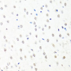 Chromatin Accessibility Complex 1 (CHRAC1) Antibody