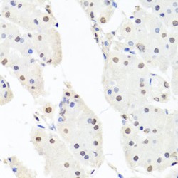 Chromatin Accessibility Complex 1 (CHRAC1) Antibody