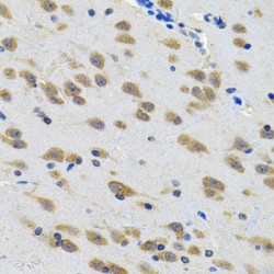 Leucine Rich Repeat Containing G Protein-Coupled Receptor 6 (LGR6) Antibody