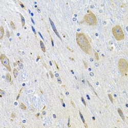 Leucine Rich Repeat Containing G Protein-Coupled Receptor 6 (LGR6) Antibody