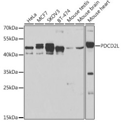 Programmed Cell Death Protein 2-Like (PDCD2L) Antibody