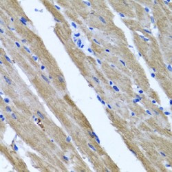 Gasdermin E (GSDME) Antibody