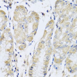 Fanconi Anemia Group A Protein (FANCA) Antibody