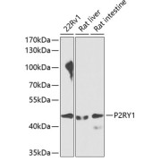 Western blot analysis of extracts of various cell lines, using P2RY1 antibody (1/1000 dilution).